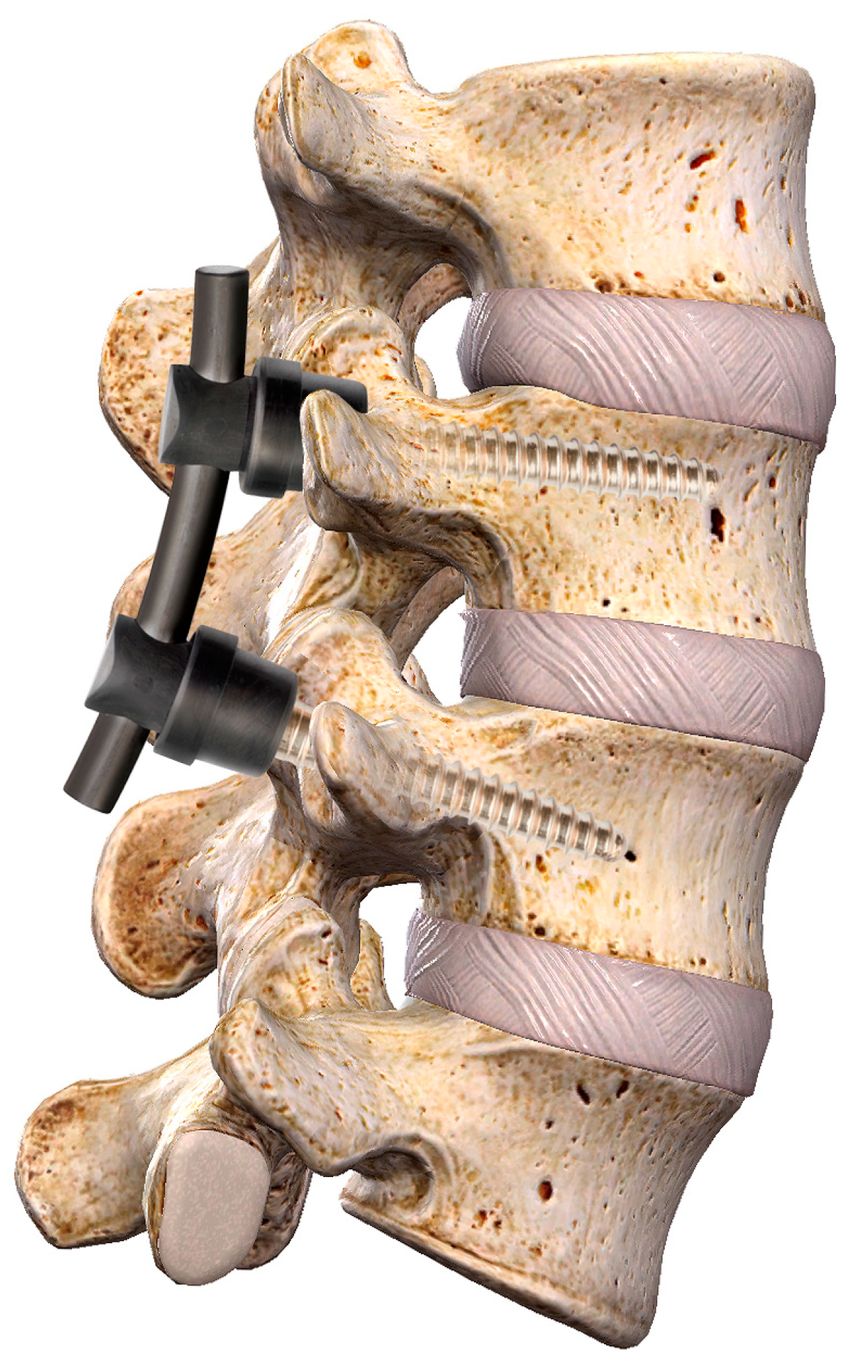Pomyśl o masażu i terapii manualnej jako o najlepszej alternatywie, która może uchronić Cię przed koniecznością tak drastycznej "pomocy".