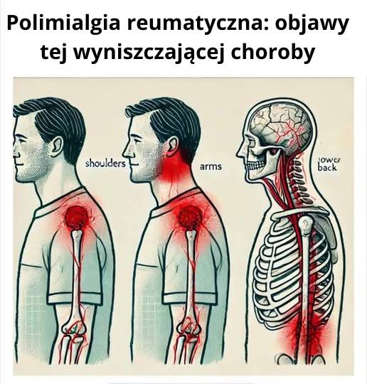 Polimialgia Reumatyczna to silny ból i poranna sztywność barków, bioder i karku. Specjalistyczny masaż i terapia manualna pomogą Ci odzyskać zakres ruchu i ulgę w codziennym funkcjonowaniu!