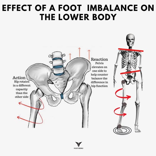 Zapomnij o doraźnym leczeniu samych pleców. Masaż i terapia manualna pomogą Ci zająć się źródłem problemu – nierównowagą postawy stóp, która "ciągnie" Twoje biodra i kręgosłup.