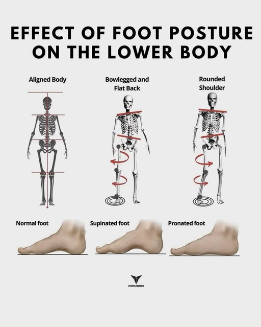 Problem z plecami? Sprawdź, co robią Twoje stopy! Większość bólu pleców to efekt nierównowagi. Masaż i terapia manualna to inteligentna inwestycja, która patrzy na ciało jako całość.